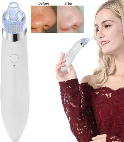 Kemei Blackhead Sucker Machine 8050 / Kemei Km-8050 Beauty Skin Care Specialist-jumabazar